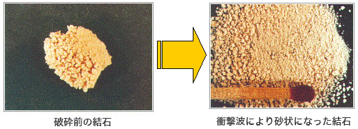 結石破砕室で行われる検査 エックス線診療室6 大和市立病院